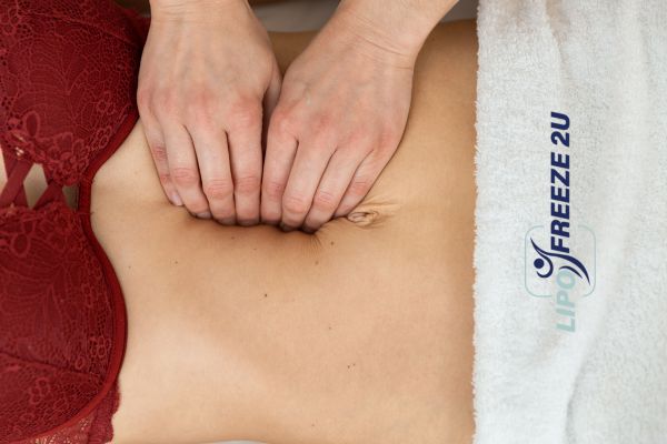 diastasis recti treatment Gravesend