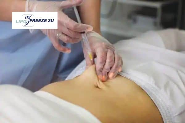 Fat Dissolving Injections Gravesend & Weight loss medication
