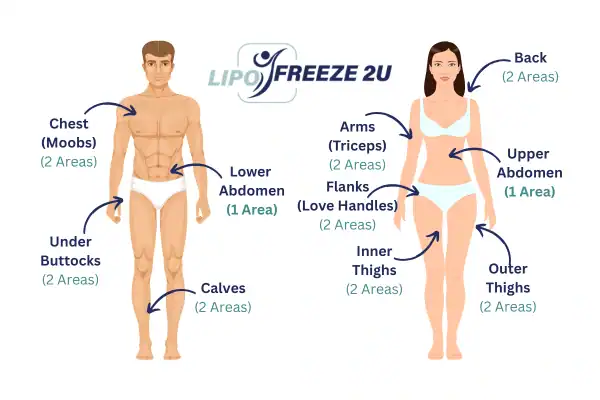 Areas you can have fat freezing treatment Gravesend