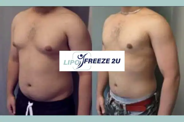 How Long Does It Take to See Results Gravesend?