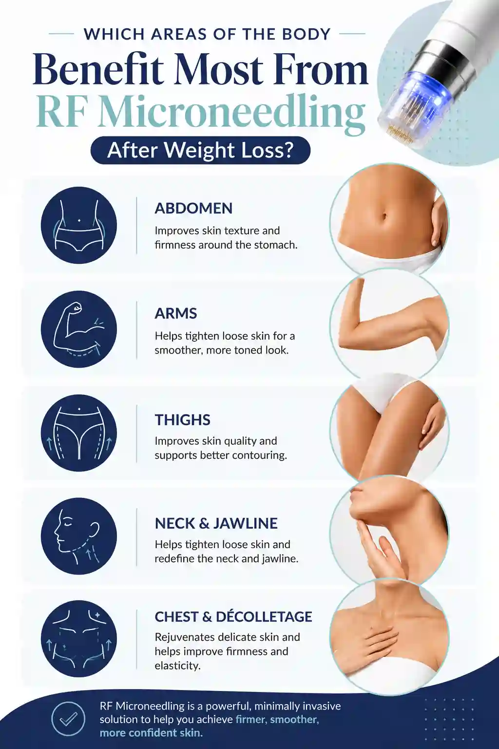 Which Areas of the Body Benefit Most From RF Microneedling After Weight Loss Gravesend